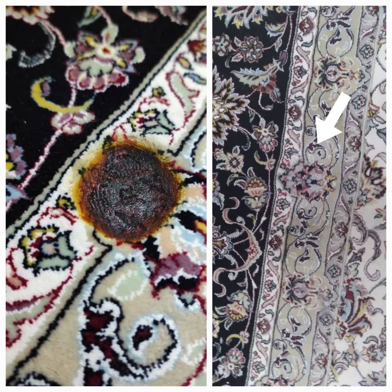 ترمیم سوختگی